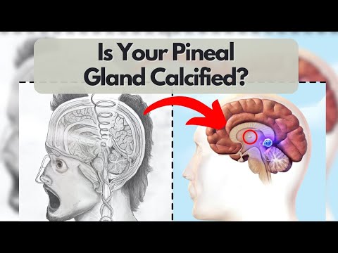 Pineal Gland Decalcification & More