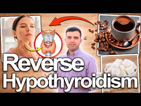 HOW TO TREAT HYPOTHYROIDISM - Reverse Thyroid Disease and Eliminate It's Symptoms Naturally