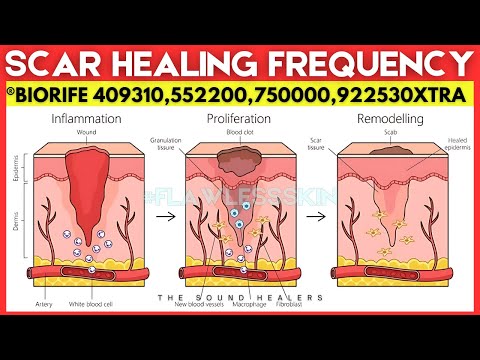 heal skin scar tissue - Ver 1 0 ( Energetic Infusion )