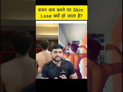 Ultimate Trick/Fact To Prevent Loose Skin During Weight Loss | चमड़ा ढीला क्यों हो जाता है?#shorts