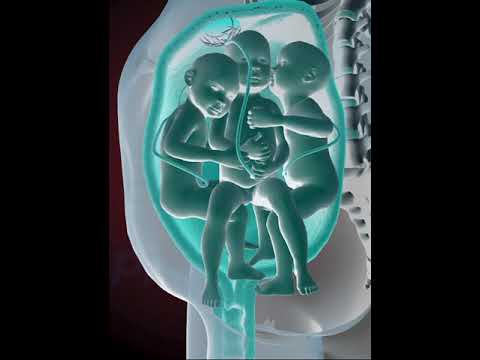 PRECIOUS MOMENTS OF TRIPLETS INSIDE THE WOMB  (3D ANIMATION)