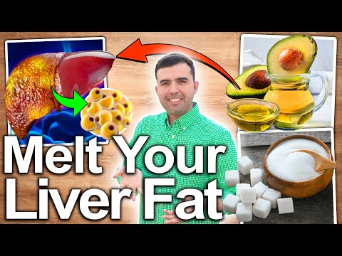 HOW TO ELIMINATE FATTY LIVER 100% - BEST DIET, THE MOST EFFECTIVE NATURAL TIPS EVER