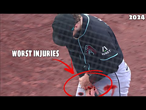 MLB• Worst Injuries Of June•|2024