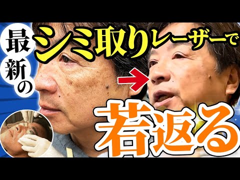 【おじさんのシミ取り体験記】施術時間や痛みは？いまおじさんがシミをとる理由とは！？ #シミ取り #シミ