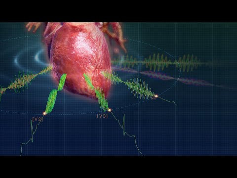 Medical Device | MOA Animation