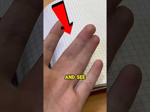 Webbed Fingers Are So COOL 😨 #viral