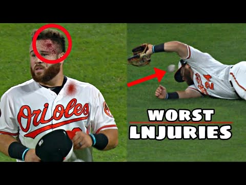 Worst lnjuries in Baseball Part 2