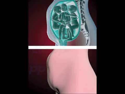 PRECIOUS MOMENTS OF TRIPLETS INSIDE THE WOMB  (3D ANIMATION)