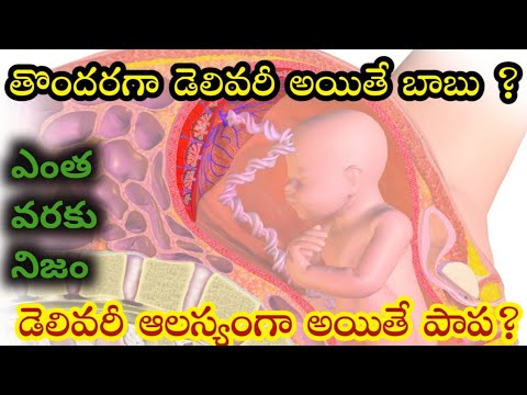 early delivery during pregnancy baby boy |gender prediction| boy or girl #gender