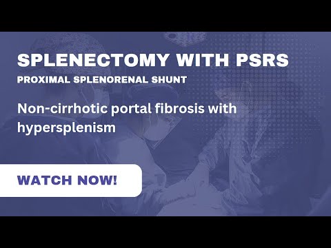 Splenectomy with PSRS (Proximal splenorenal shunt)