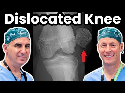 Dislocated Patella - Orthopaedic Surgeons Explain