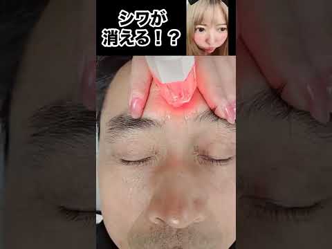 もはや魔法？！シワが消えるレーザーが凄い China TikTok reaction #shorts