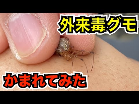 新手の外来毒グモにかまれてみた【ハイイロゴケグモ】