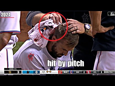 MLB• Worst Hit By Pitch| Part3️⃣