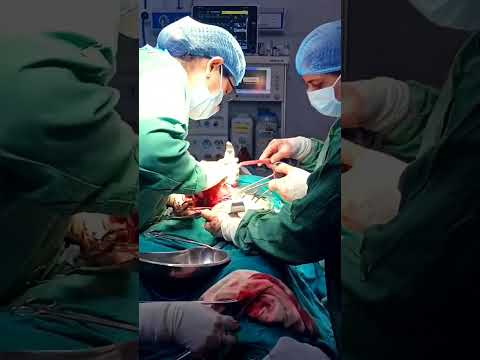 SURGERY  #motivation #aiims #doctor