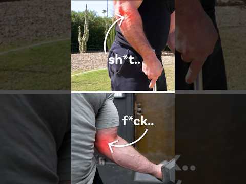 Got Tennis or Golfers Elbow? This is How You Fix Them! #golferselbow #tenniselbow #elbowpain