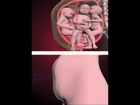 PRECIOUS MOMENTS OF TRIPLETS INSIDE THE WOMB  (3D ANIMATION)