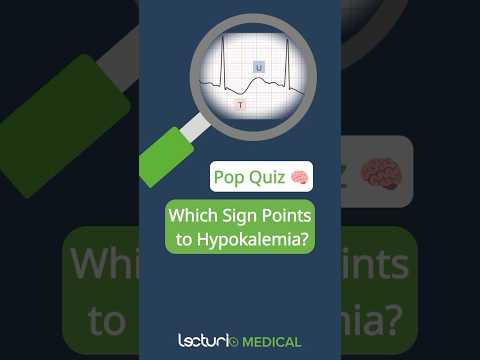 Quiz Time! 📊 Identify the Hypokalemia Sign on EKG