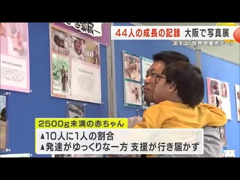 小さく生まれた子供たちの成長の記録　大阪で写真展　17日は「世界早産児デー」 (2024/11/16 18:06)