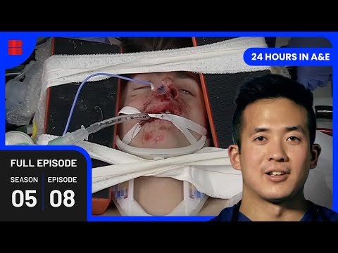 Critical Care for a Skateboarding Tragedy - 24 Hours In A&E - Medical Documentary