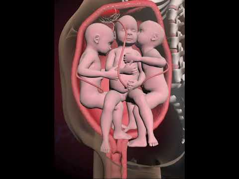 PRECIOUS MOMENTS OF TRIPLETS INSIDE THE WOMB  (3D ANIMATION)