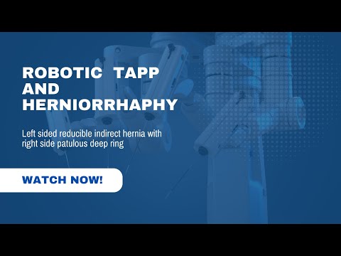 Robotic TAPP and Herniorrhaphy