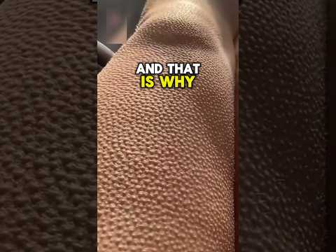 What Are These Weird Bumps?? 😨 #viral