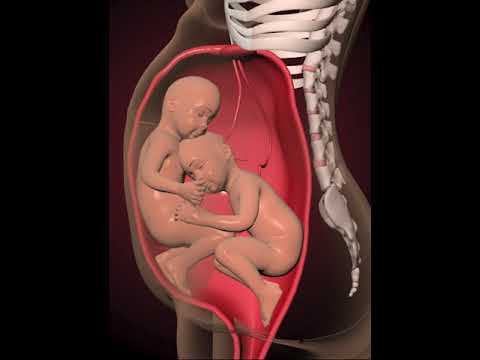 Amazing Twins inside the womb (3D Animation)