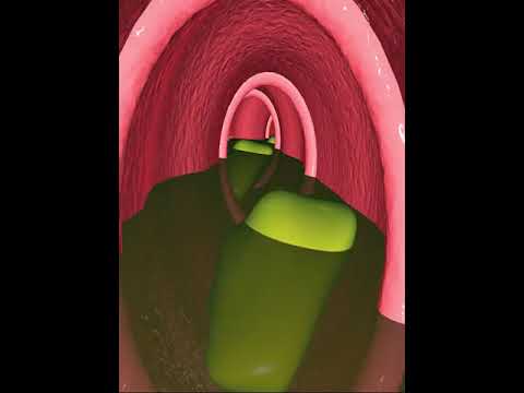 Digestive system- anatomy of small intestines' (3D Animation )