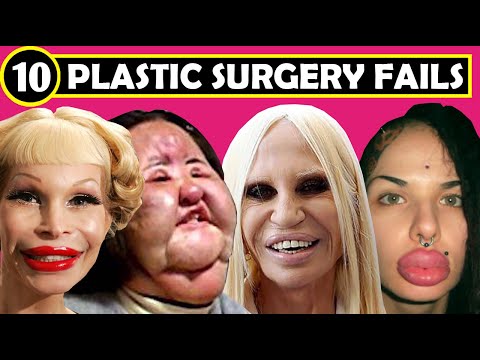 TOP 10 BOTCHED PLASTIC SURGERY FAILS - ( Plastic Surgery Before and After | FACE )