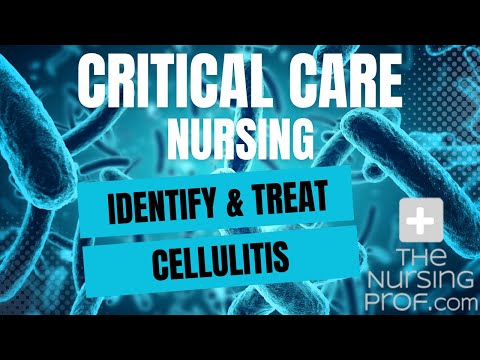 Critical Care Nursing: Identify and Treat Cellulitis