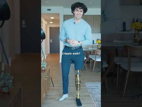 How I walk with my Prosthetic Leg?!