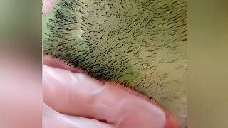 #satisfying ASMR Waxing and beard removal #relaxing蜜蜡脱毛拔胡子 超解压视频 #relaxation #stressrelief #amazing