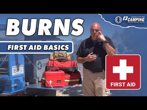 First Aid Basics: Burns #e3camping #firstaid