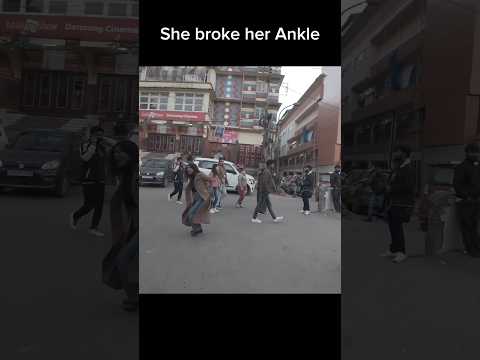 She broke her ankle