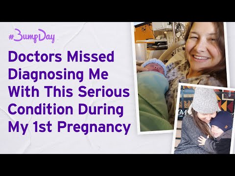 Doctors Missed Diagnosing Me With This Serious Condition | #BumpDay