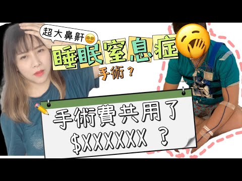 超嘈鼻鼾？忍了多年？睡眠窒息症手術費用分享 ? 原來張婆脾氣很好@聖保祿醫院 st paul's hospital