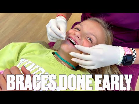 NINE YEAR OLD GETTING BRACES OFF EARLY | HOW TO SHORTEN TIME WITH BRACES