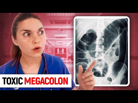 Day in the Life of a DOCTOR: Hospital Vlog: TOXIC MEGACOLON