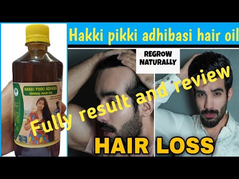 Hakki pikki Adhibasi hair oil Fully results and reviews 🤑🤑🤑🤑 खरिद ने से पहले जान लो 🤑🤑🤑🤑🤑🤑🤑🤑