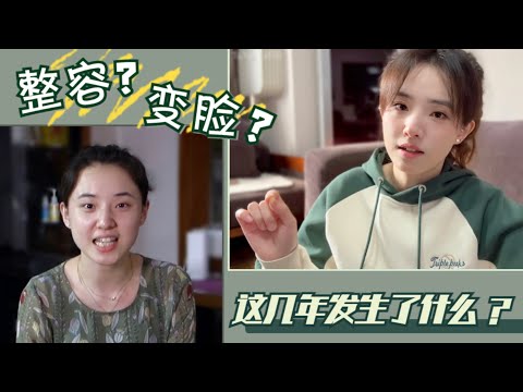 网传我自己“百万整容”是真是假？我“变脸”的真相究竟是什么？