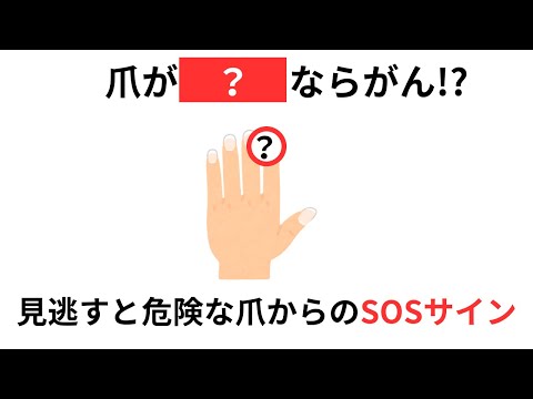 【警告！】あなたはこんな症状ありませんか？？？【見逃すと危険な爪からのSOSサイン】（有料級な雑学）