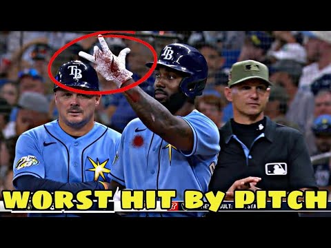 MLB• Worst Hit By Pitch 4th week April 2024