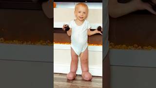 Get Ready for a Toddler Cuteness Overload! #shorts #disabledandcute #viralvideo