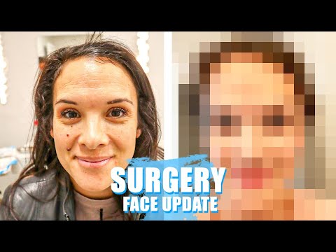 MOM has Face Surgery!