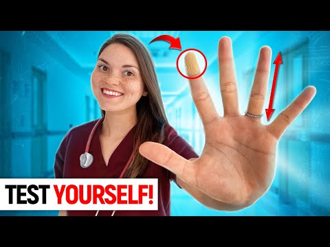 What your HANDS say about your HEALTH: Doctor Explains