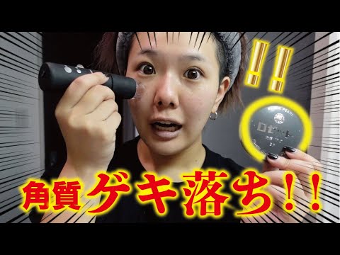 【ガチレビュー】角質に悩んでる方必見!!この商品ヤバすぎる!!