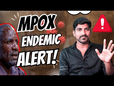 Mpox Outbreak Symptoms, History and Latest Emergency Explained | Tamil | TP