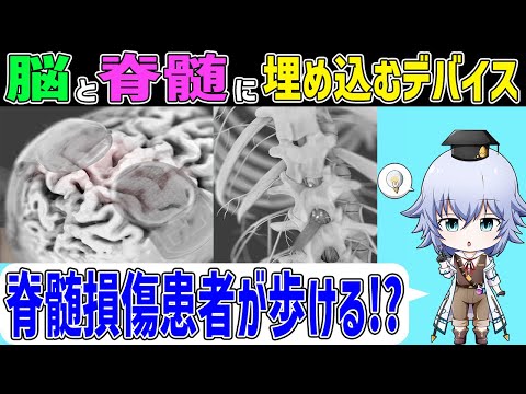 [Brain Spine Interface] 脊髄損傷の患者が脳と脊髄にインプラントで歩けるように!?[Rue] Brain Machine Interface