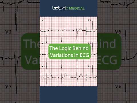 The Logic Behind Variations in ECG #usmle #usmleprep #ecginterpretation